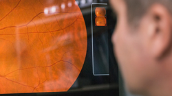 How an eye exam could save your life Image